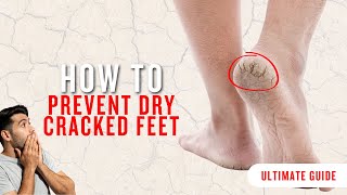 How Can You Prevent Dry Cracked Feet  Discover the Best Foot Care Tips amp Products [upl. by Landes468]