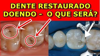 Dente Restaurado Doendo  O que pode ser O que fazer [upl. by Latoye396]