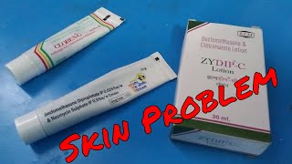 Skin Problem alergy Solution [upl. by Eyatnod]