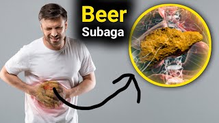 Beer sugaba iyo bararka beerka 4sheey ayaa sababi karta ee ka Taxadar [upl. by Wera]