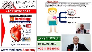 Dilated Cardiomyopathy cme internalmedicine medical usmle محاضراتباطنة [upl. by Rodmur]