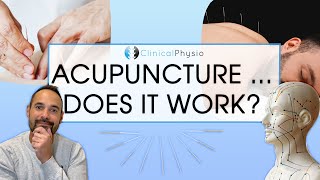 Does Acupuncture Work in Physiotherapy  Expert Physio Reviews the Evidence [upl. by Sarene]