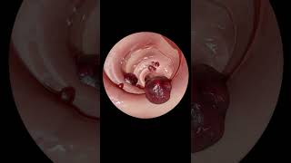 The ULTIMATE Guide to Gastrointestinal Endoscopy  Step by Step Tutorial [upl. by Ellord925]