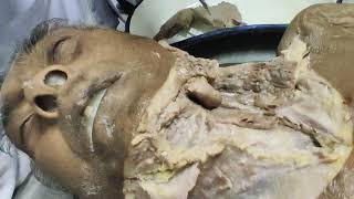 Dissection video by Dr Arnab sir Malda medical college [upl. by Leima]