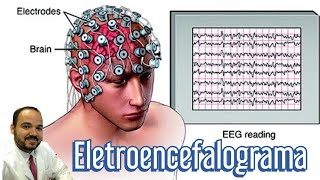 Eletroencefalograma EEG o que é tipos e para que serve o exame [upl. by Ulah]