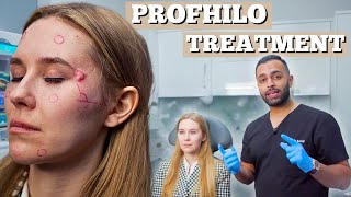 Profhilo Treatment  Dermal Filler For Fine Lines amp Wrinkles  Dr Somji amp Dr Solomon Demonstrate [upl. by Ehcnalb]