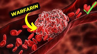 The Ultimate Guide to Understanding Warfarin Its Benefits and side effects [upl. by Dann]