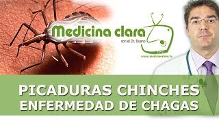 Picadura por chinches y enfermedad de Chagas  Como tratar las picaduras de chinches [upl. by Llert]