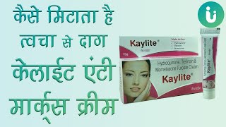 Kaylite Cream के फायदे नुकसान  Kaylite Cream lagane ka sahi tarika uses review price in hindi [upl. by Pip]