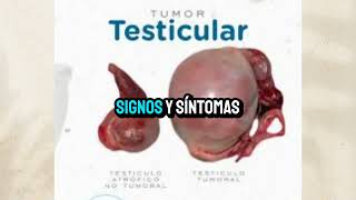 Tumor testicular [upl. by Nedyarb]