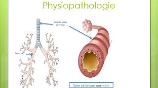 4 Asthme bronchique  Quatrième Année Médecine [upl. by Bruner]