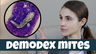 DEMODEX MITES ON YOUR SKIN DR DRAY [upl. by Narak450]