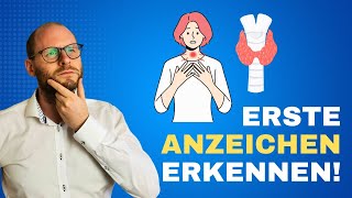 Erste Anzeichen von Schilddrüsenproblemen So erkennst du sie [upl. by Aryan187]