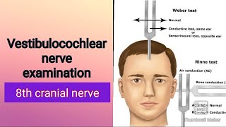 8th cranial nerve examination Physiology [upl. by Waiter]