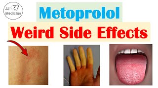 Metoprolol amp Beta Blockers Weird Side Effects Skin Gastrointestinal Psychological [upl. by German]