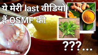 ये मेरी last vedio है OSMF की। submucous Fibrosis Treatment।osmf को कैसे पहचाने। कैसे ठीक करें [upl. by Entsirhc]