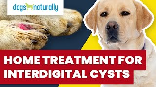 Home Treatment For Interdigital Cysts [upl. by Lanaj200]