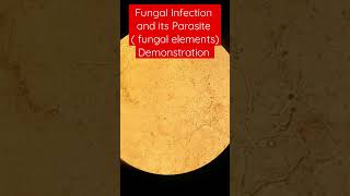 Fungal infection and its parasite Demonstration [upl. by Liw959]