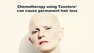 Taxotere Lawsuit  Chemotherapy Drug Causes Permanent Hair Loss [upl. by Oirevlis]