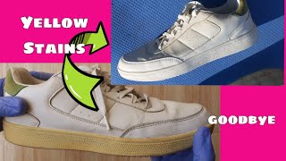 How to Whiten your Yellowish White Sneakers  Goodbye to Yellowish Stains [upl. by Ardel]