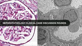 20230221 Nephropathology Clinical Case Discussion Rounds [upl. by Rettig]