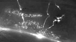 Axon regeneration in response to nervous system injury [upl. by Paynter453]