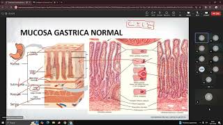 SEMINARIO Mucosa Gástrica 1  Dr Nieves [upl. by Roderich665]