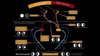 Visual Pathway amp Visual Field Defects  Dr MDM [upl. by Yblok]