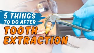 5 things to do after Tooth Extraction  Orthosquare Dental Clinic  Dental Care [upl. by Brendon]