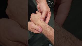 Chiropractic Adjustment  Wrist Adjustment  Chiropractor [upl. by Notxarb386]