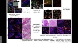 Netosis en Enfermedades Autoinmunes [upl. by Sirrep]