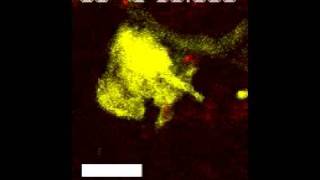 A dermal dendrite cell containing multiple vacuoles capturing an Leishmania parasite [upl. by Helyn]