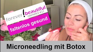 MICRONEEDLING mit BOTOX bei mir selbst durchgeführt [upl. by Avat638]