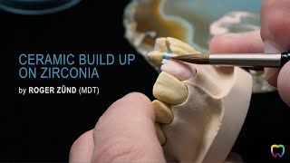 Ceramic build up on zirconia by MDT Roger Zünd [upl. by Arda]