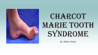 CharcotMarieTooth syndrome [upl. by Leacock]