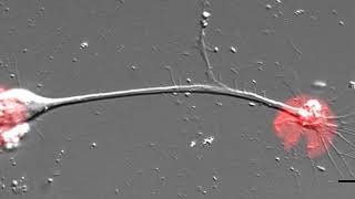 Cytoskeletal Mechanisms of Axonal Contractility [upl. by Conlon]