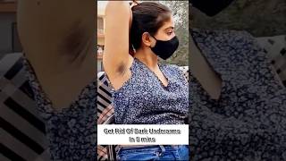 🔥Best Home Remedies For Dark Underarms 😱 100 Effective ✅ shorts skincare [upl. by Surdna431]