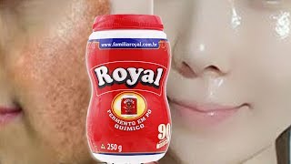 PELE de Bebê em poucos DIAS USE PÓ ROYAL para Remover MANCHAS e RUGAS da PELE [upl. by Goldy601]