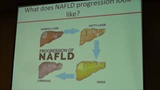 Ask the Experts 61017 NonAlcoholic Fatty Liver Disease NAFLD VS NASH by Lisa Richards MSN FNP [upl. by Hgielek201]