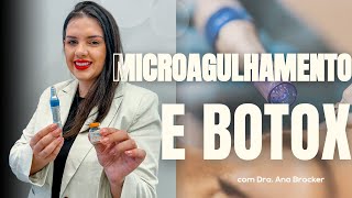 COMO FAZER MICROAGULHAMENTO COM BOTOX  Técnicas associadas [upl. by Ayanat]