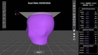 Measurement amp Comparison Utility  Orthomerica 3D Scanning [upl. by Etnoed601]