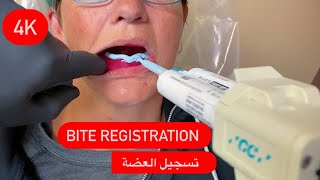 BITE REGISTRATION  تسجيل العضة عربي وانجليزي [upl. by Cyndia760]