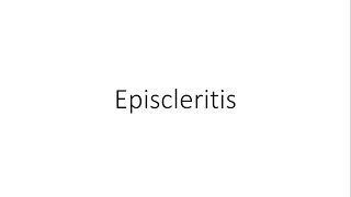 Episcleritis  Ophthalmology [upl. by Obeng]