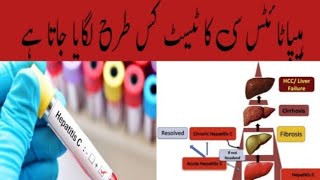 HCV Test Kaisy Kiya jata Hain  HCV Test kya HOTA Hai  Hepatitis C Virus Test [upl. by Weidar]