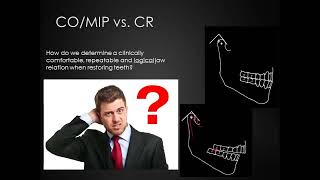 Occlusion for Prosthodontics [upl. by Ethelinda450]