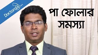 Edema in leg  Swollen leg  Types Causes Symptoms amp Treatment in Bangla [upl. by Hnirt]