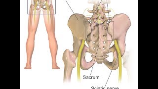 Sacroiliac Joint Pain Explained by Top Pain Doctor in Las Vegas Nevada [upl. by Zebadiah]