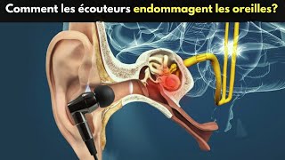 Comment les écouteurs endommagent nos oreilles   Les écouteurs sontils nocifs [upl. by Sugihara]