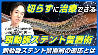 切らずに治療できる！頚動脈ステント留置術CASとは？脳神経外科医 吉村紳一Drが徹底解説！ [upl. by Ardy]