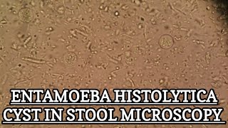 Entamoeba Histolytica Cyst under stool microscopy MLT WORLD [upl. by Oker]